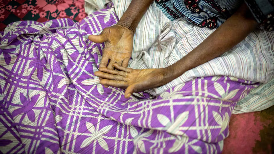 Internacional/África: Milhões de Africanos HIV-positivos Enfrentam o Desafio da Velhice, A Luta Silenciosa de Joseph Malagho