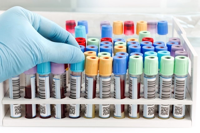 Quando e por que fazer um check-up médico: guia prático para cuidar da sua saúde